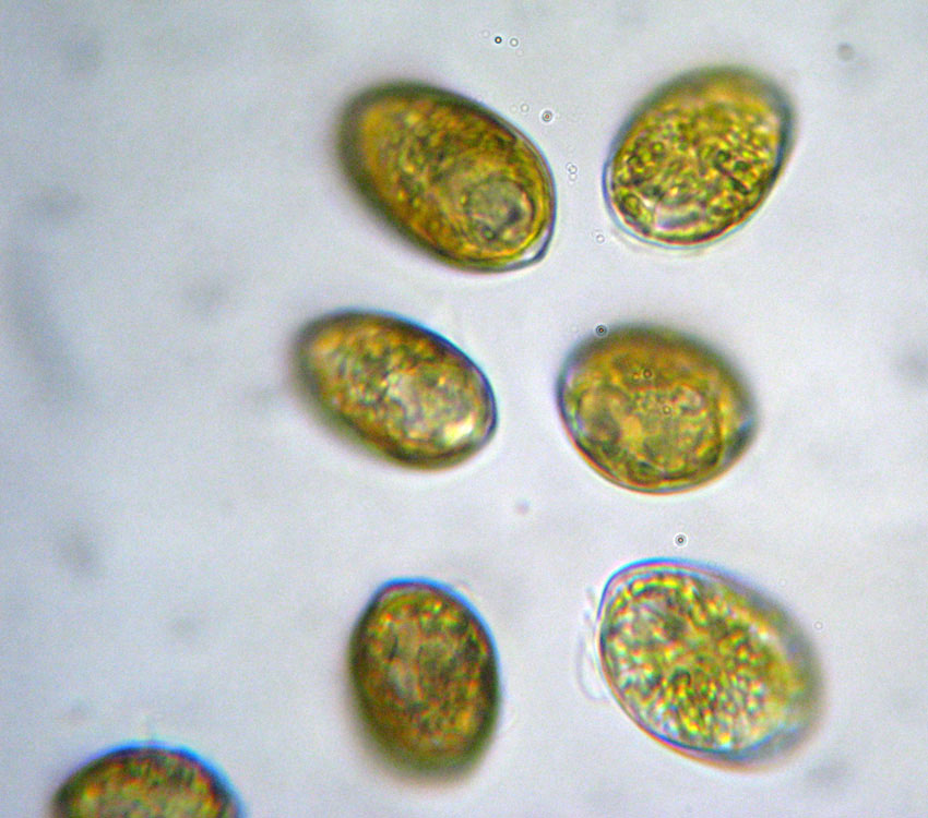 Probabile Prorocentrum minimum, dinoflagellato marino